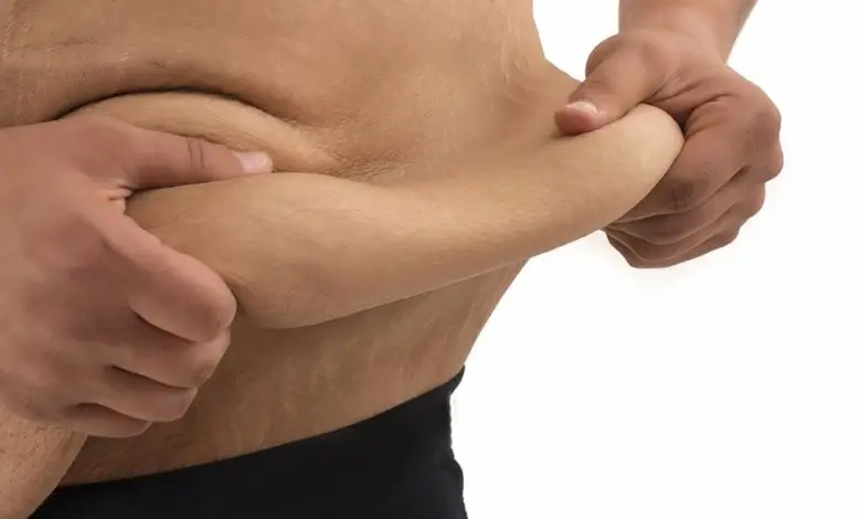 عمليات التجميل بعد جراحات السمنة